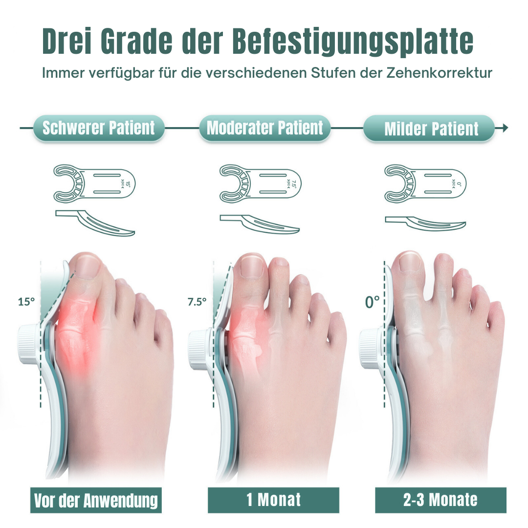 PATENTIERTE Hallux Valgus (Ballenzeh) Schiene & Training Komplett-Set