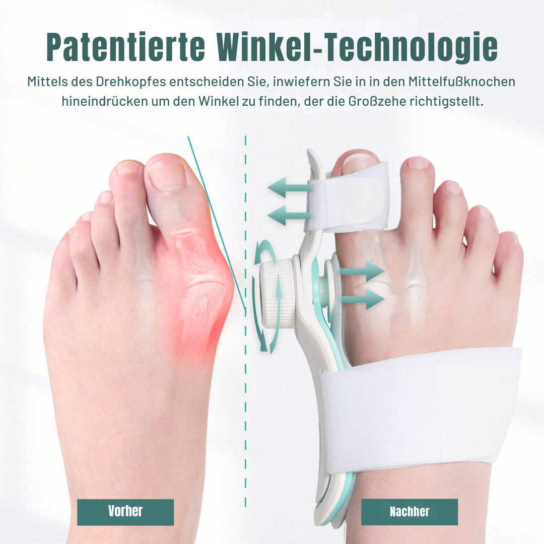 PATENTIERTE Hallux Valgus (Ballenzeh) Schiene & Training Komplett-Set